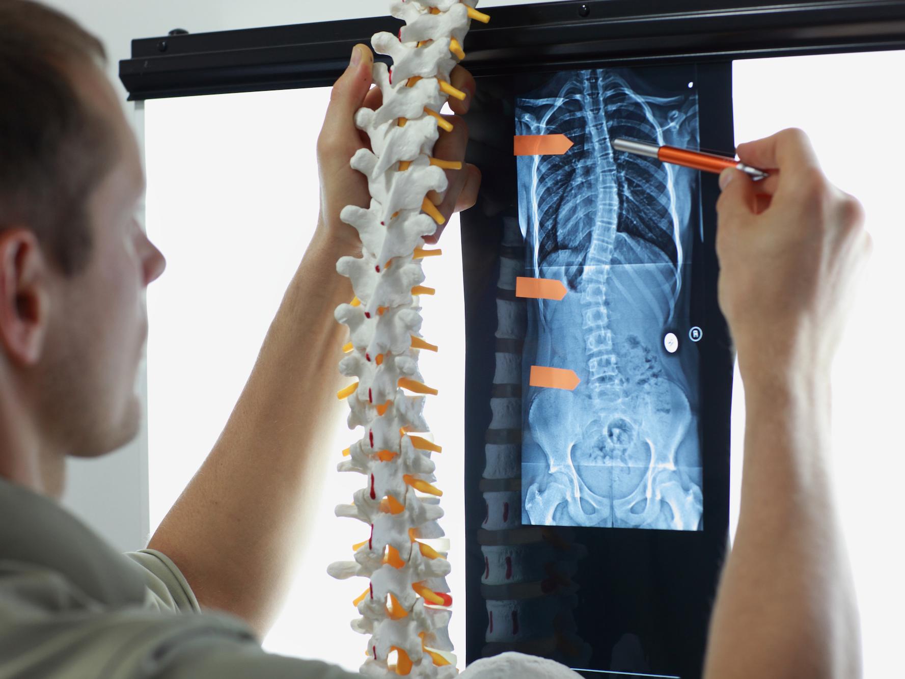 A health professional reads a spine x-ray