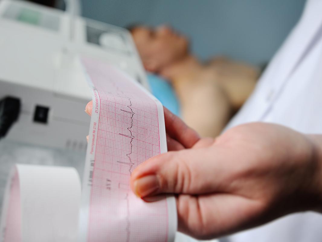 Technician holds EKG electrocardiogram printout