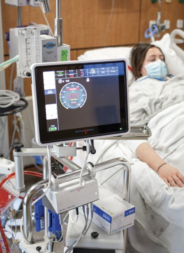 What Is ECMO?