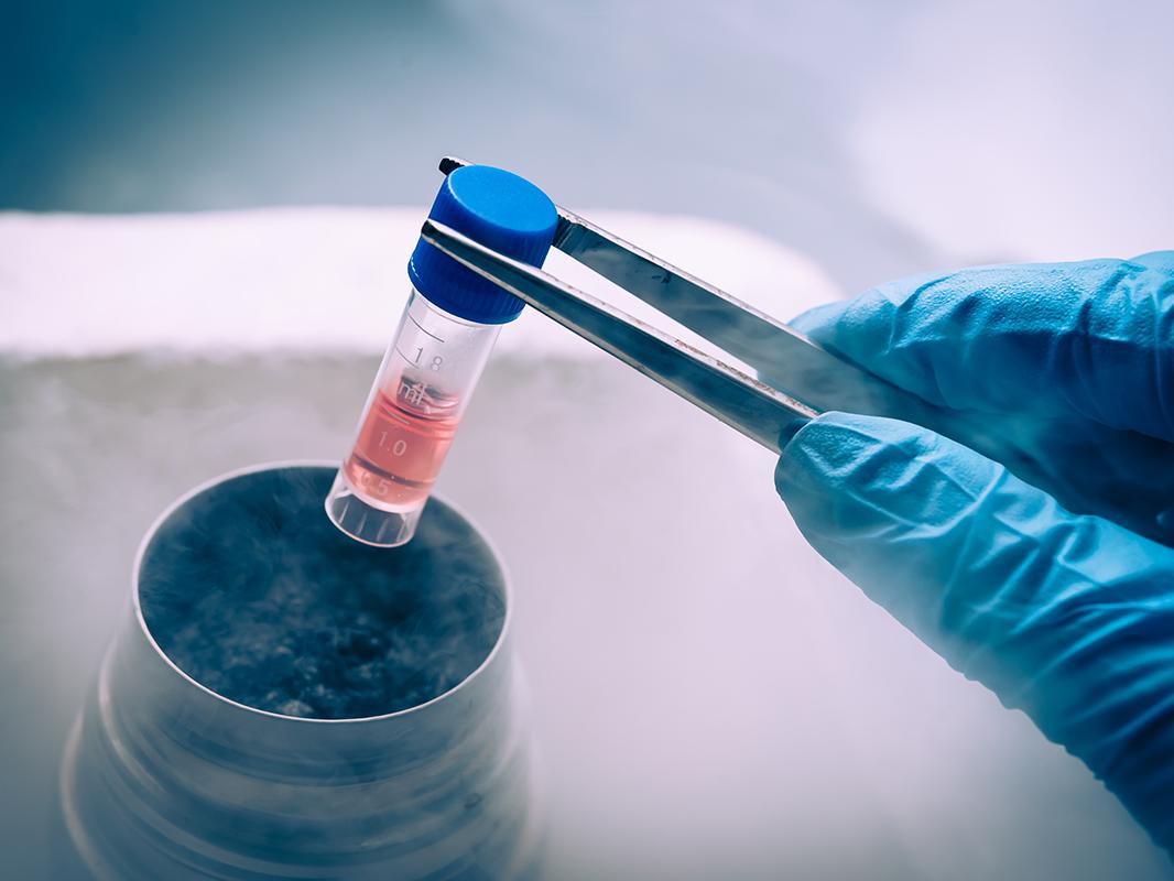 A lab tech drops a test tube into a freezer with tweezers
