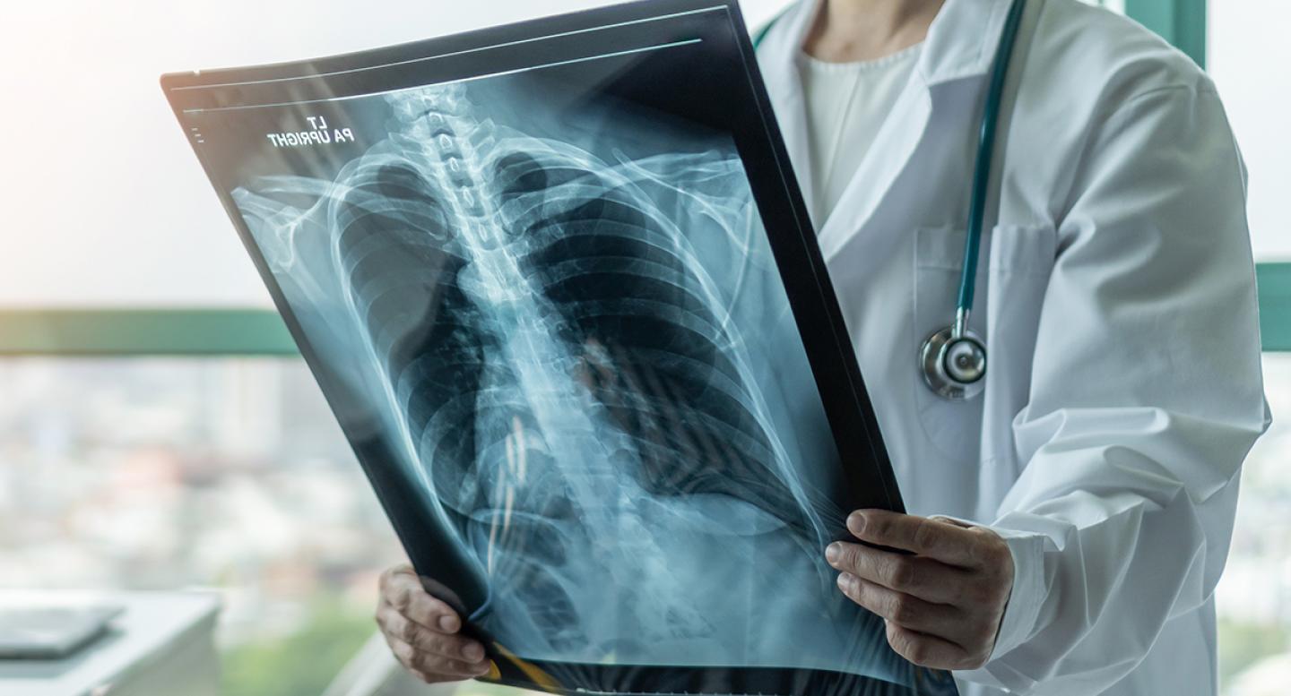 Female doctor holding x-ray