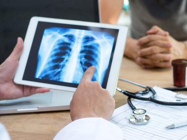 A doctor reviews an X-ray with a patient