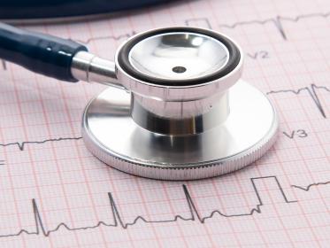 Stethoscope sitting on an ECG printout