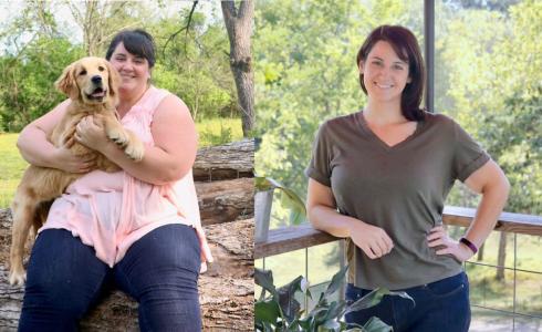 University Bariatric Center before and after photo