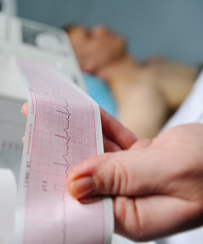 Technician holds EKG electrocardiogram printout