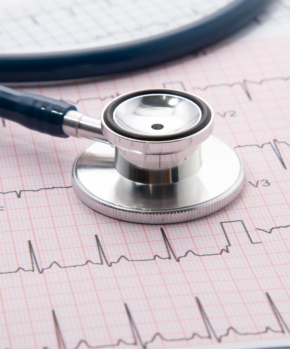 Stethoscope sitting on an ECG printout